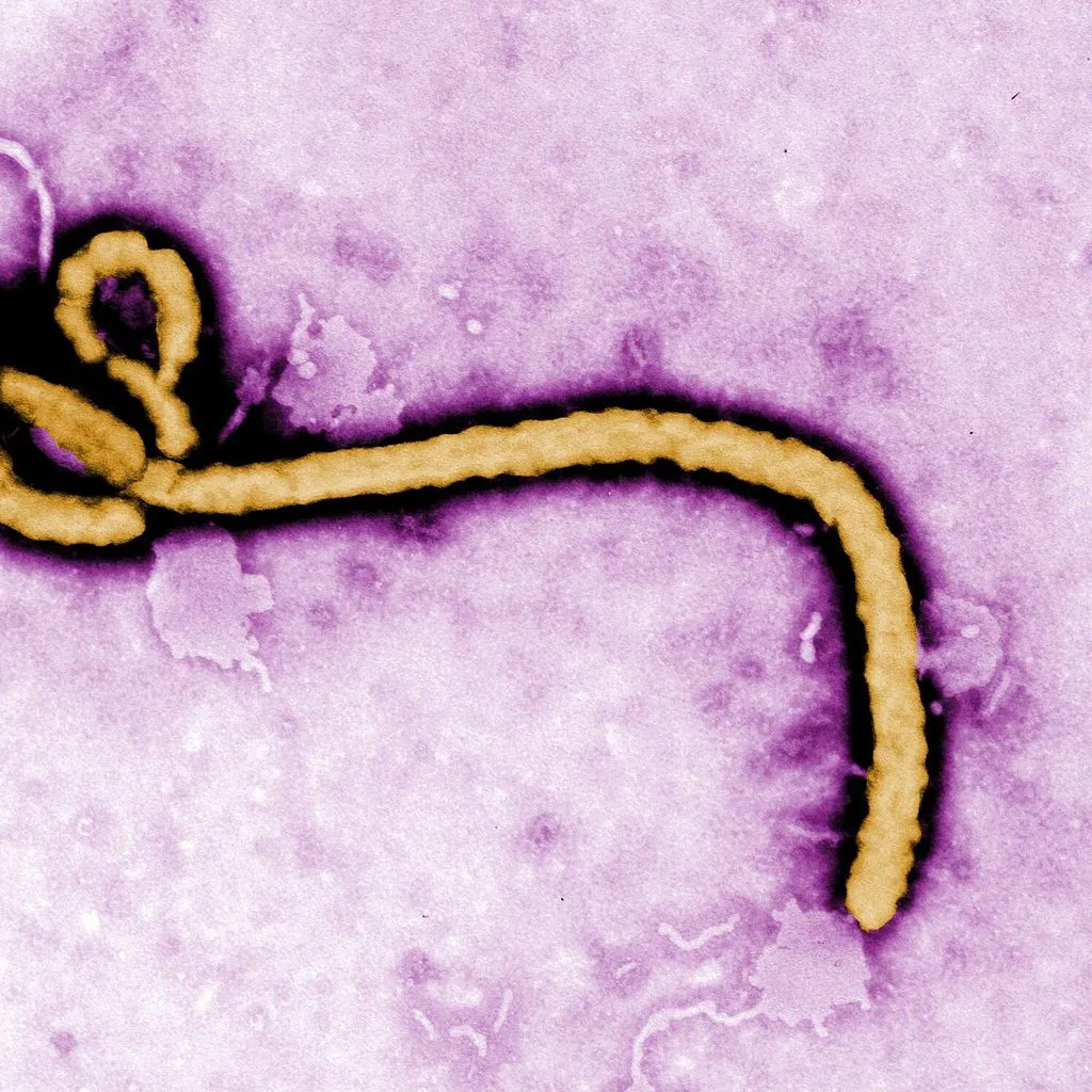 Ebola virus (2)