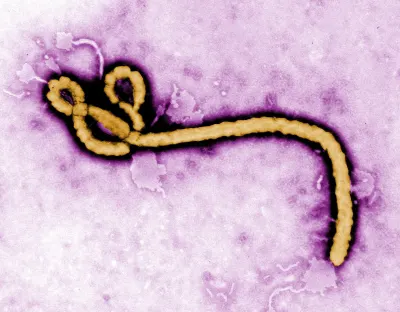 Ebola virus (2)